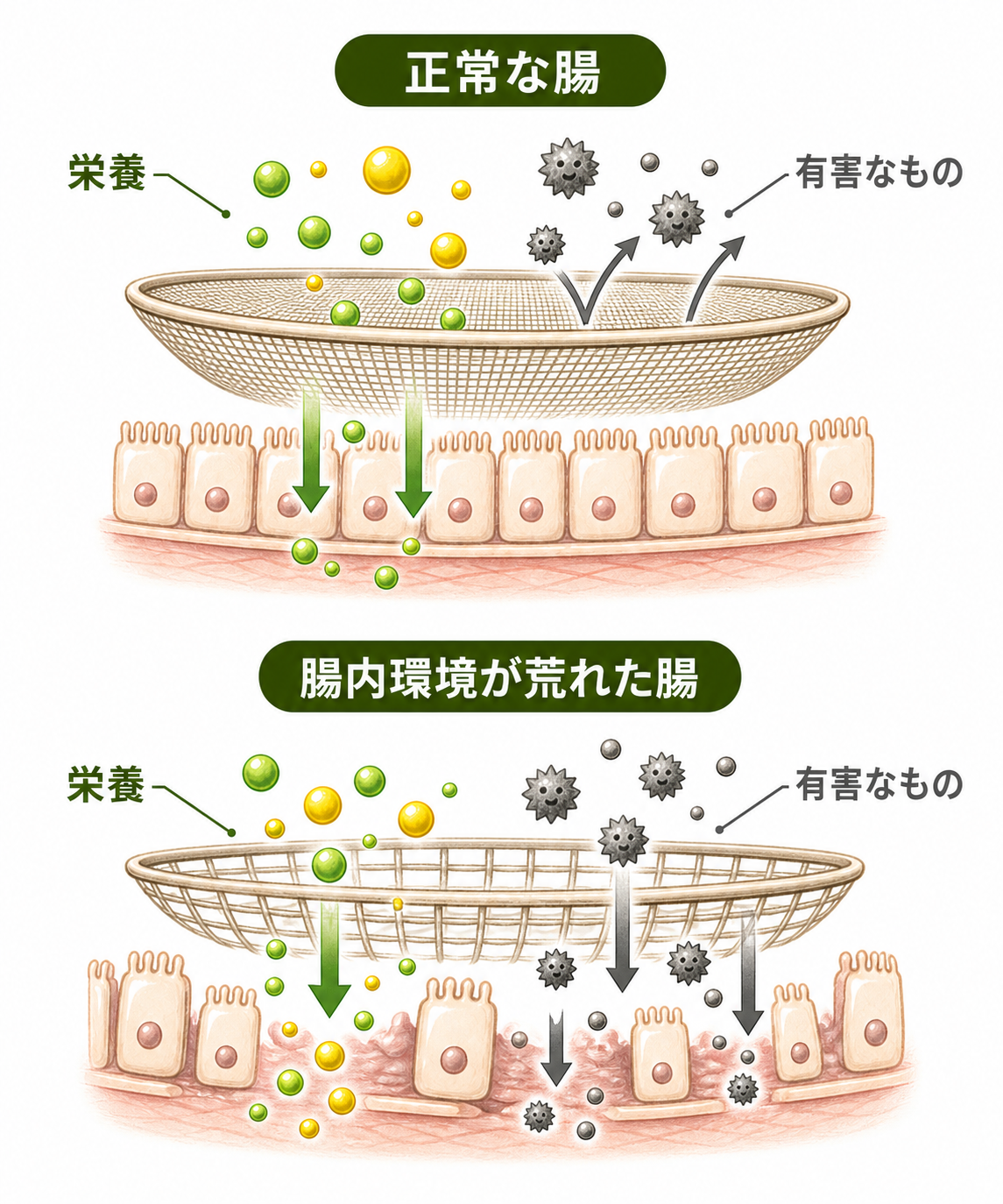 腸のザルのイメージ